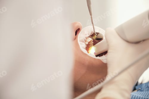 Preview: Anonymous dentist making teeth scan