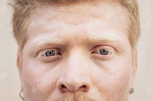 Preview: Close up portrait of an albino latino man