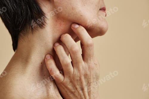 Preview: Woman with short hair scratching neck anxiety or skin condition