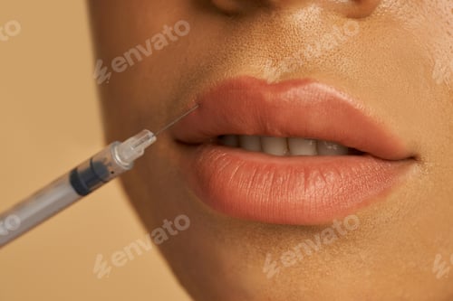 Preview: Close up shot of cosmetic injection to the lips of young woman isolated over beige background