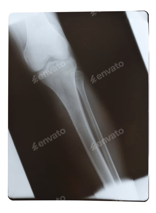 Preview: X-Ray shot