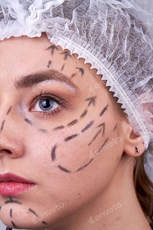 Preview: Vertical shot of womans face with dotted lines.