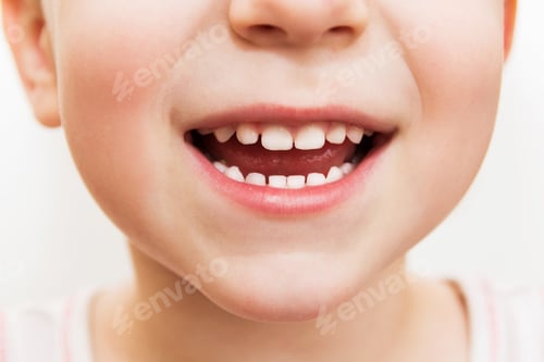 Preview: baby smile close. child teeth on a white isolated background.