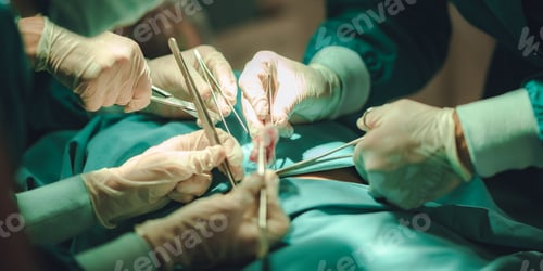 Preview: Anesthetist surgery doctor professional team are working in hospital operating room