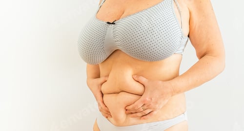 Vista previa: overweight woman holds fold of excess fat on stomach