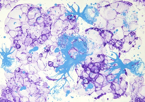 Preview: Closeup of the foam bubbles