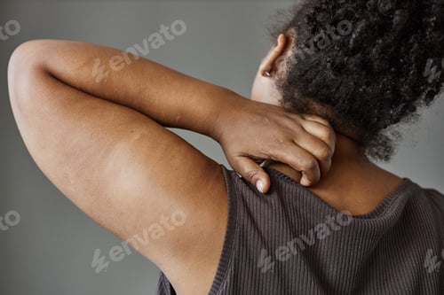 Preview: Black Woman Scratching Neck Closeup