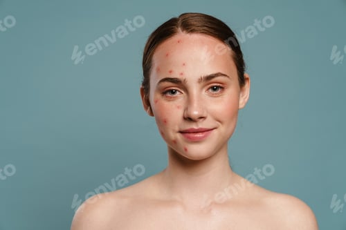 Preview: Half-naked ginger woman with pimples smiling and looking at camera
