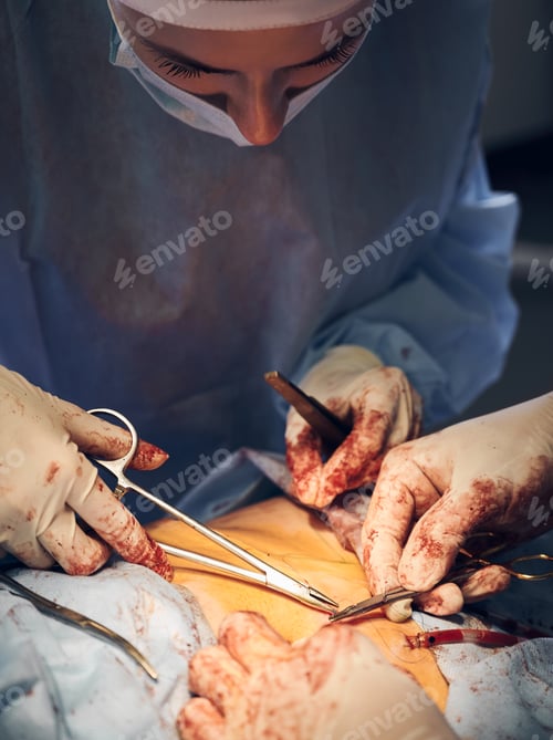 Preview: Surgeons Performing Delicate Surgery in Hospital Setting