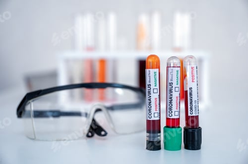 Preview: Sample of blood test tubes for diagnosis coronavirus, covid-19 infection and safety glasses in lab