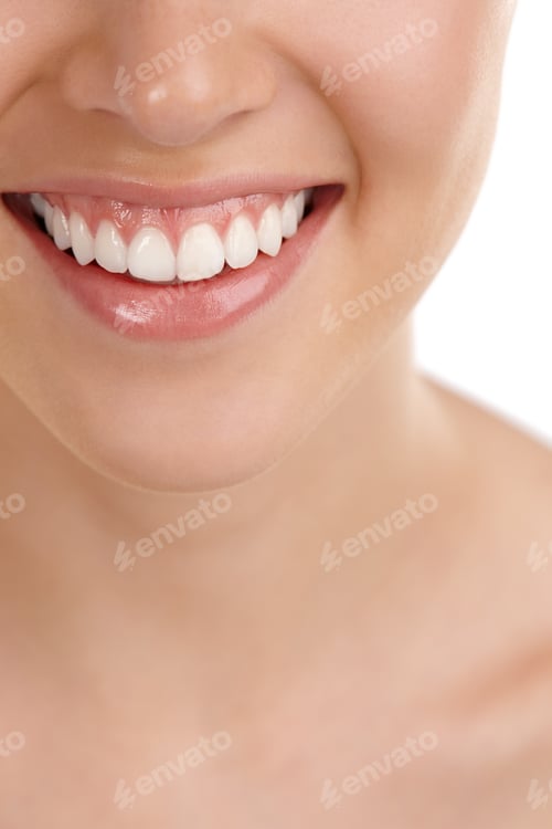 Preview: Pearly whites