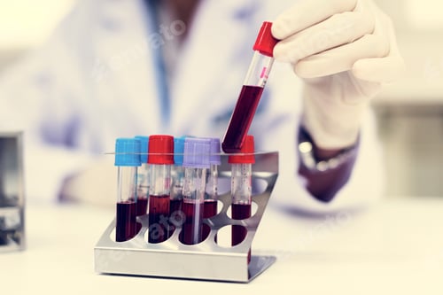 Preview: Doctor checking blood samples