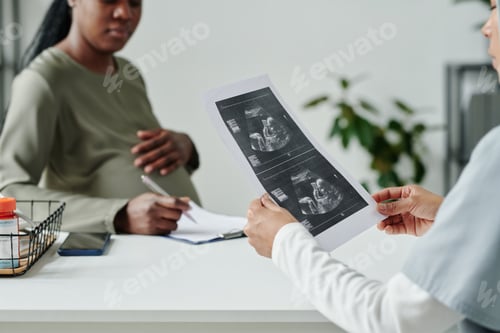 Preview: Sonogram of fetus held by gynecologist