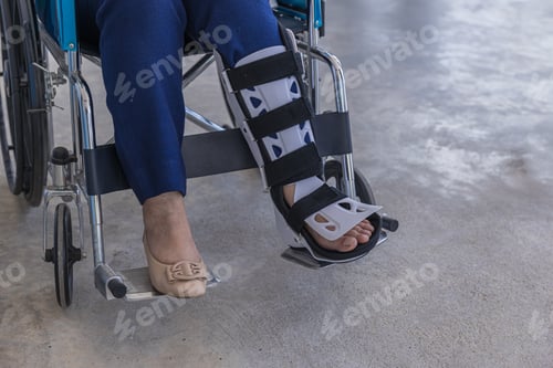 Preview: Foot orthosis concept. woman leg with adjustable ankle foot orthosis brace,night splint.