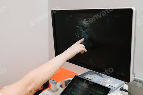 Preview: Prenatal checkup with ultrasound performed on pregnant woman