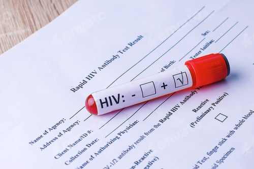 Preview: HIV Test Tube With Blood Plasma on Medical Report