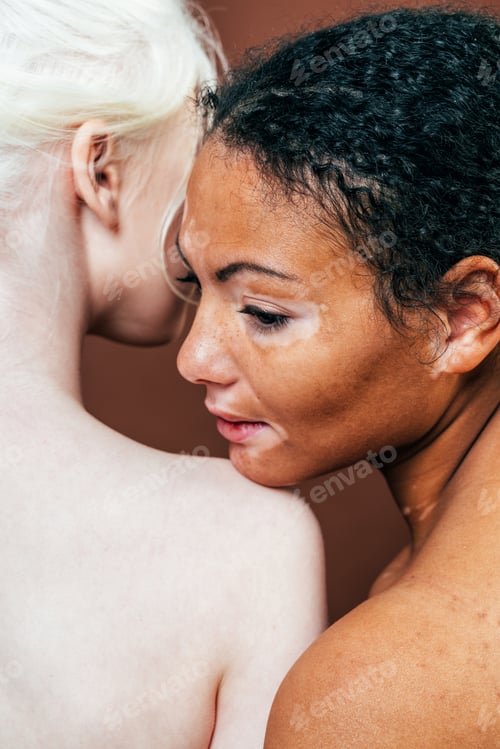 Preview: Group of multiethnic women