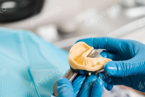Preview: Detailed view of dental cast of patient?s jaw before implantation procedure