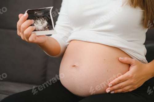 Preview: Pregnant woman hands holding ultrasound photo