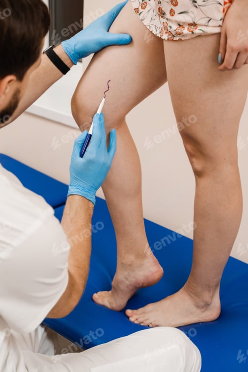 Preview: Vascular surgeon marks veins for varicose surgery prior to operation in medical clinic