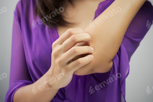 Preview: itching