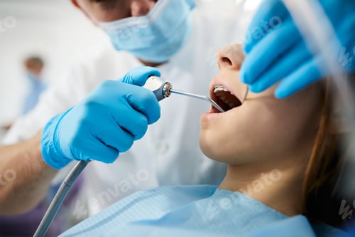 Vista previa: Close up of teenage girl having her teeth checked by dentist at dental clinic.