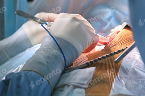 Preview: Surgical Procedure in Operating Room