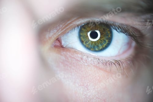 Preview: Closeup of a beautiful green heterochromia eye under the lights
