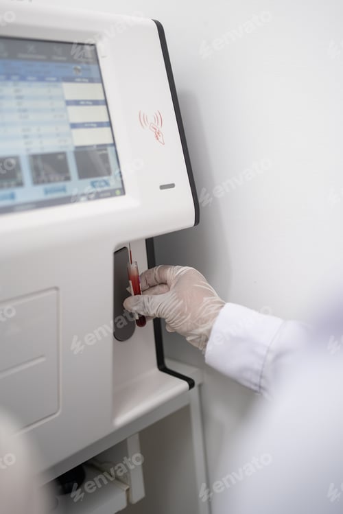 Preview: A scientist's hand analyzing a blood test