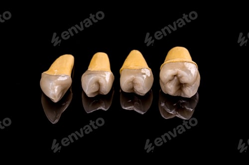 Preview: Prosthetic teeth