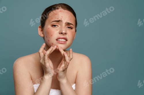 Preview: Ginger young woman wearing towel squeezing pimple on her face
