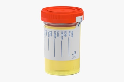 Preview: Sterile Urine Specimen Container, Orange Lid