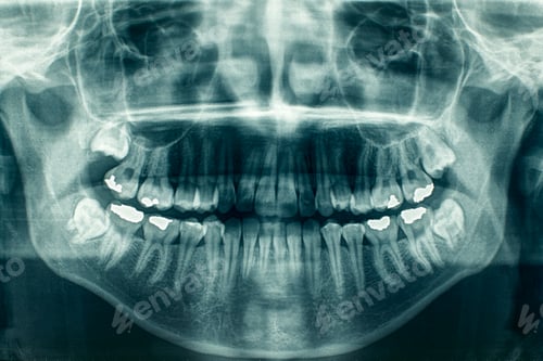 Preview: Panoramic dental X-Ray