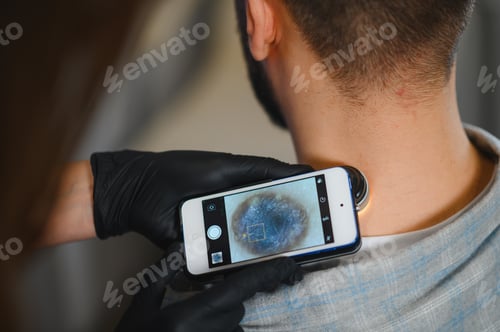 Preview: Doctor using smartphone dermoscope checking patient's mole for skin cancer