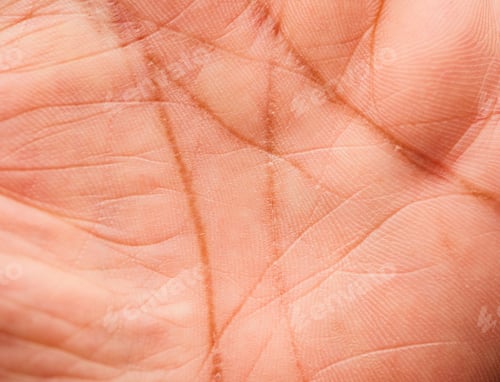 Preview: Close up of Human Skin