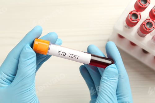 Preview: Scientist holding tube with blood sample and label STD Test at white table, top view