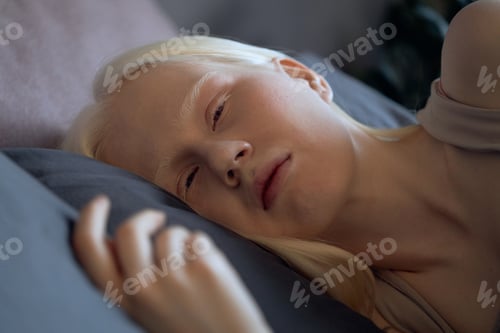 Preview: Woman with Albinism Relaxing in Bed Early in Morning