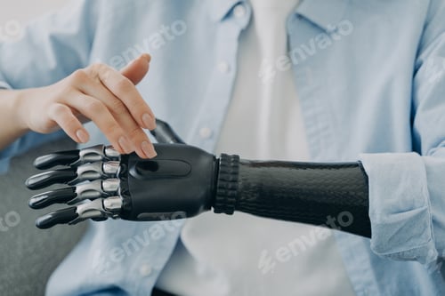Preview: Disabled female turns on sensory bionic hand prosthesis, close up. Medical high tech and disability