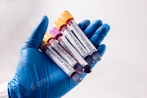 Preview: Hand of doctor holding vials with monkeypox virus