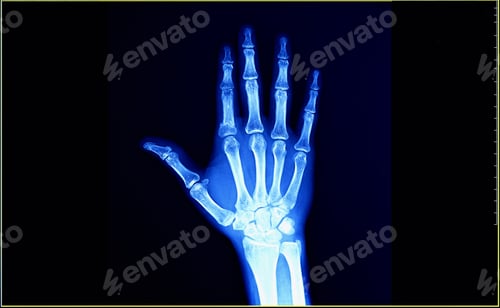 Preview: X-Ray film scan of human.