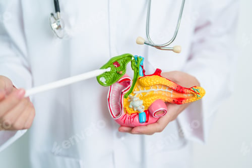 Preview: Doctor with human Pancreatitis anatomy model with Pancreas