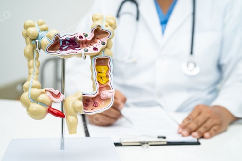 Preview: Intestine, appendix and digestive system, doctor holding anatomy model f