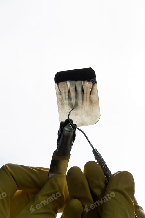 Preview: Vertical shot of the dentist showing an X-ray of damaged teeth seen against the light