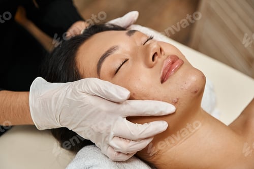 Preview: facial treatment for acne-prone skin, masseuse in latex gloves and asian woman with closed eyes