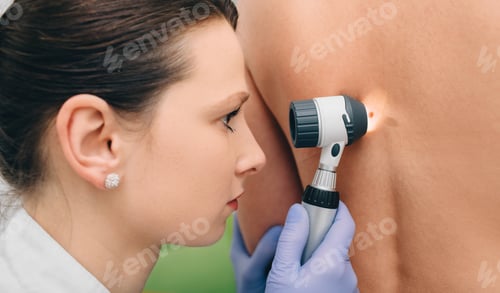 Preview: dermatoscopy. female doctor inspecting patient skin moles