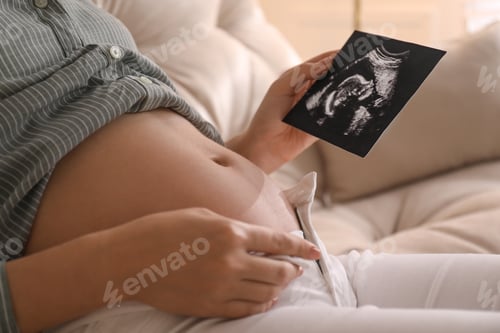 Preview: Pregnant young woman holding ultrasound picture near her belly at home, closeup