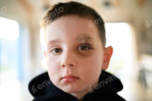 Preview: Poor sad small boy with cut eyebrow standing indoors at home, poverty concept