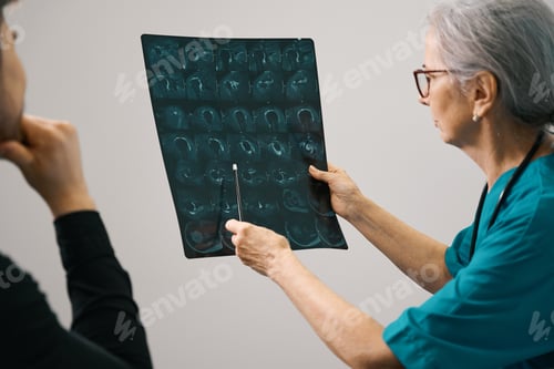 Preview: Elderly female therapist shows a patient an MRI scan of the brain