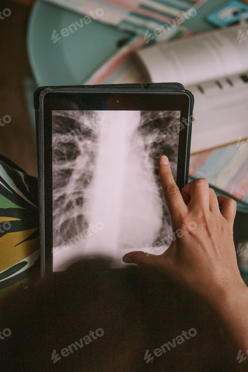 Preview: Girl analyzing a chest radiography on a tablet