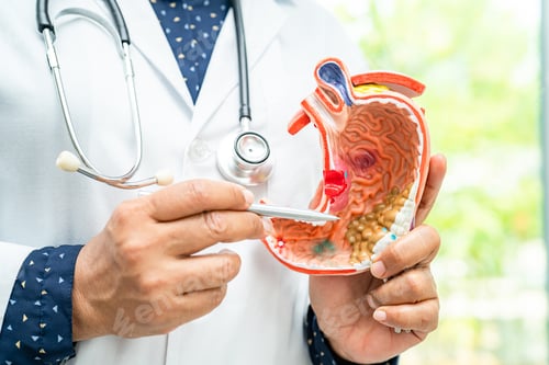 Preview: Stomach disease, doctor holding anatomy model for study diagnosis and treatment in hospital.
